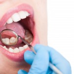 Free mouth, throat cancer screenings offered on Friday