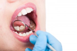 Mouth-check-(Read-Only)