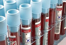 Free HIV testing available for World AIDS Day