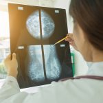 COVID vaccines leading to some breast cancer scares