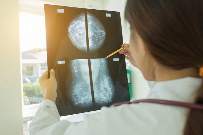 mammogram