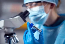 Tests confirm no local cases of monkeypox