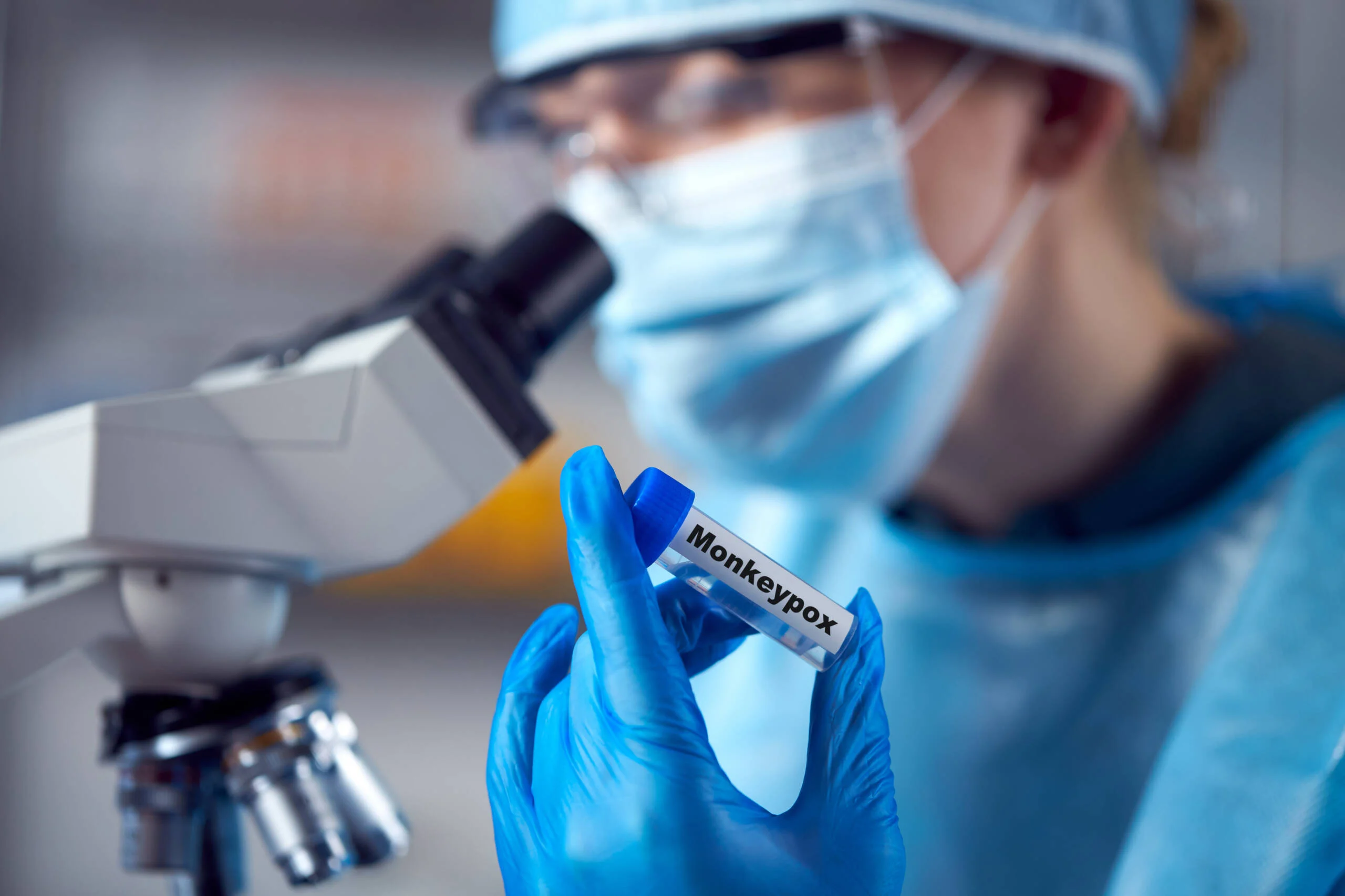 Moneypox-lab-test