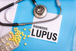 Lupus, a lifelong condition
