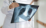 Mandatory Cancer Registry on health ministry’s radar