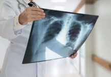 Mandatory Cancer Registry on health ministry’s radar