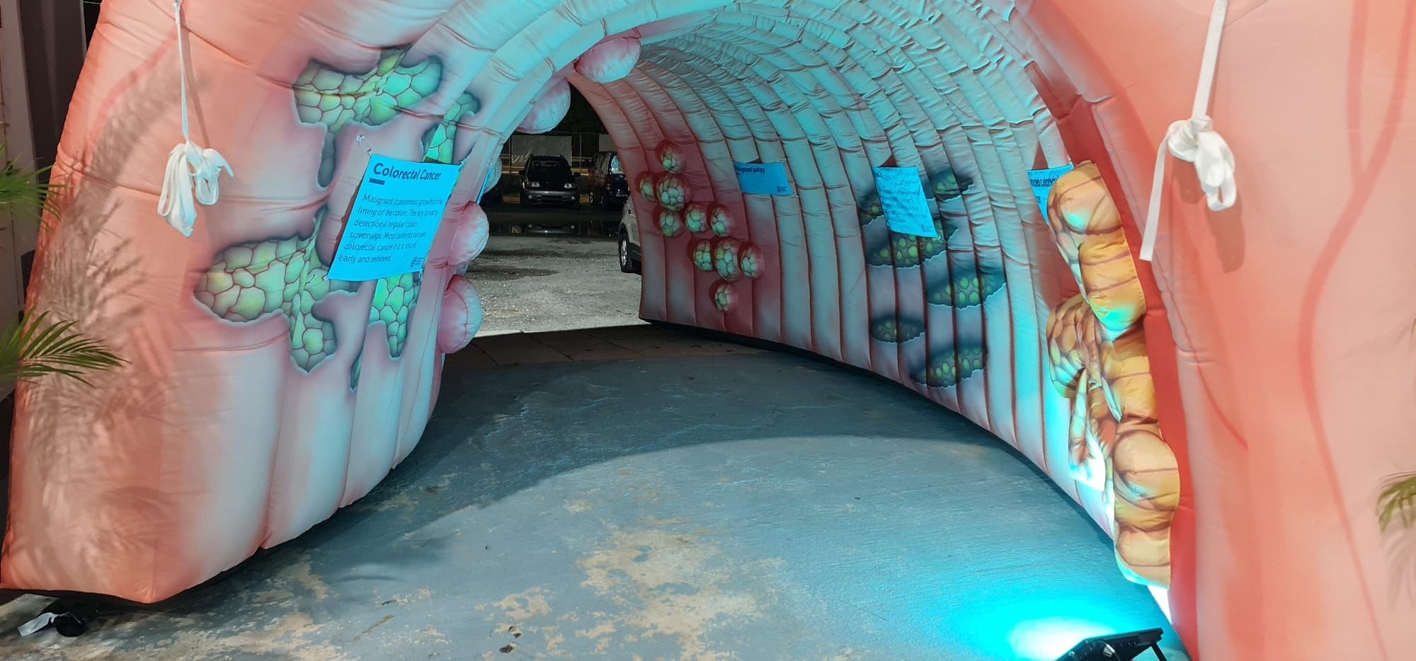 Giant inflatable colon centrepiece of Lions men's health evening