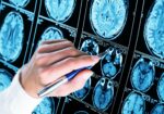 Government grants $50,000 to assist Alzheimer’s association