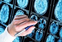 Government grants $50,000 to assist Alzheimer’s association