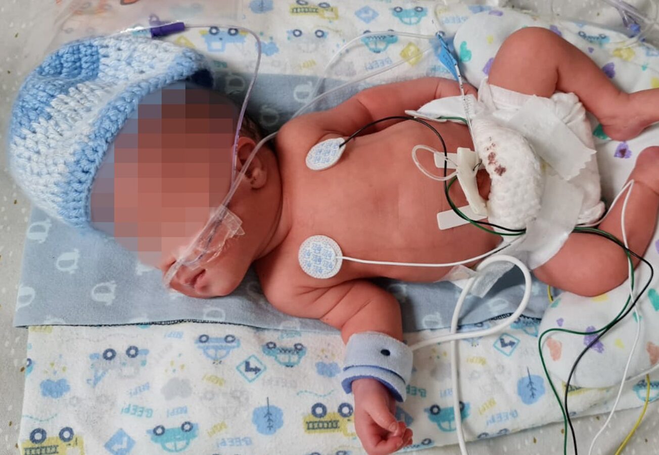 Cancerstricken mom and premature baby fight for life Cayman Compass