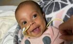 The little ‘Valkyrie’ who is fighting a rare liver disease