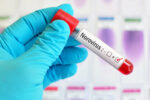 Health officials monitoring US norovirus outbreak