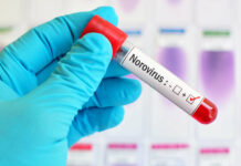 Health officials monitoring US norovirus outbreak
