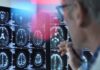 Doctors Hospital Cayman becomes first in the Caribbean to offer groundbreaking Alzheimer’s and dementia drug Donanemab