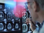 Doctors Hospital Cayman becomes first in the Caribbean to offer groundbreaking Alzheimer’s and dementia drug Donanemab