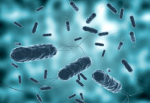 Cholera case detected in Cayman