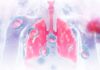 Legionnaires’ disease case under investigation Legionnaires' disease