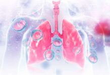 Legionnaires’ disease case under investigation Legionnaires' disease