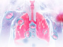 Legionnaires’ disease case under investigation Legionnaires' disease