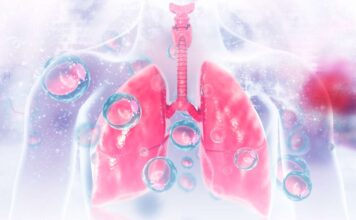 Legionnaires’ disease case under investigation Legionnaires' disease